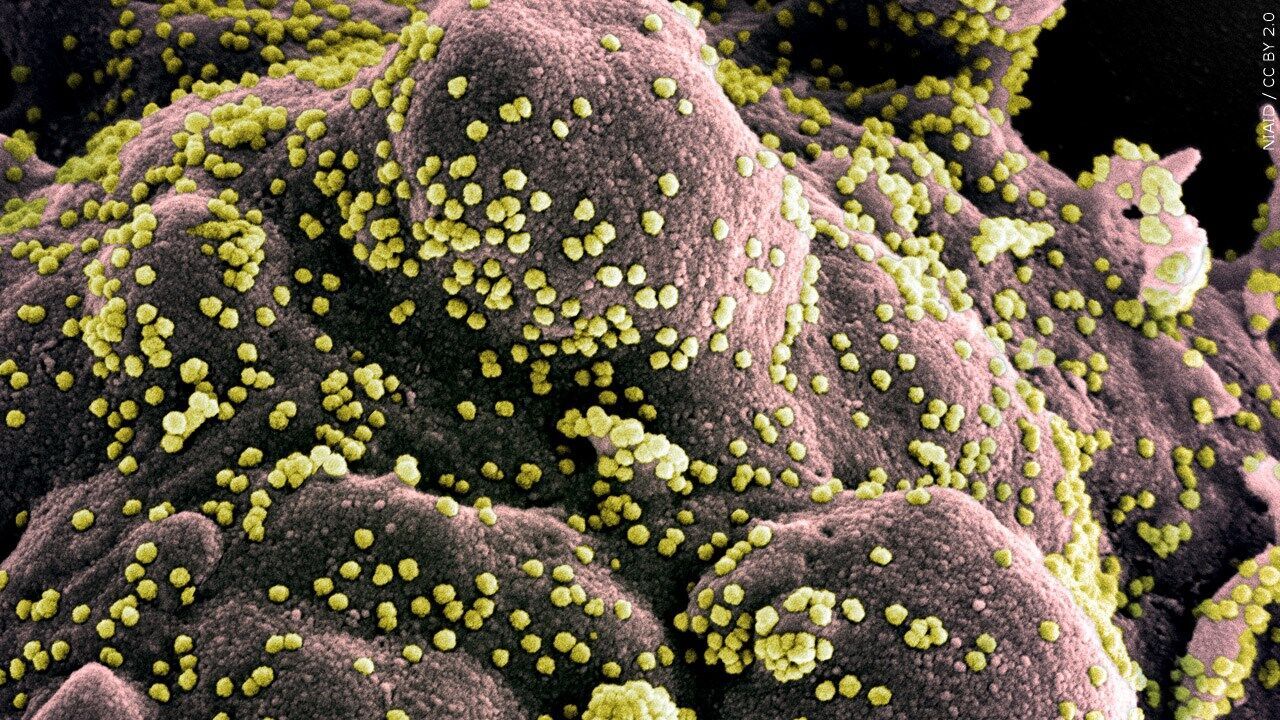 Novel Coronavirus SARS-CoV-2 COVID-19 micrograph.jpg